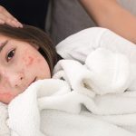 Campak: Penyakit Menular Yang Harus Diwaspadai